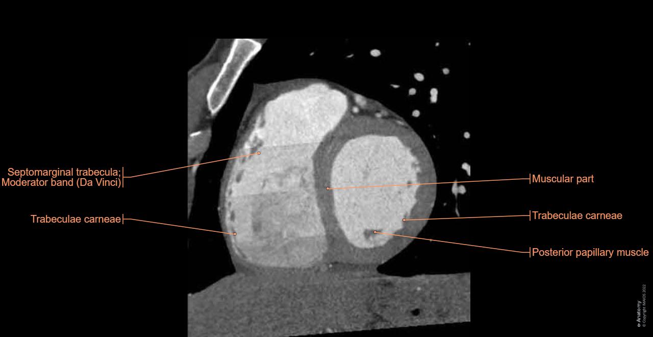 heart-ecg-territory-segment