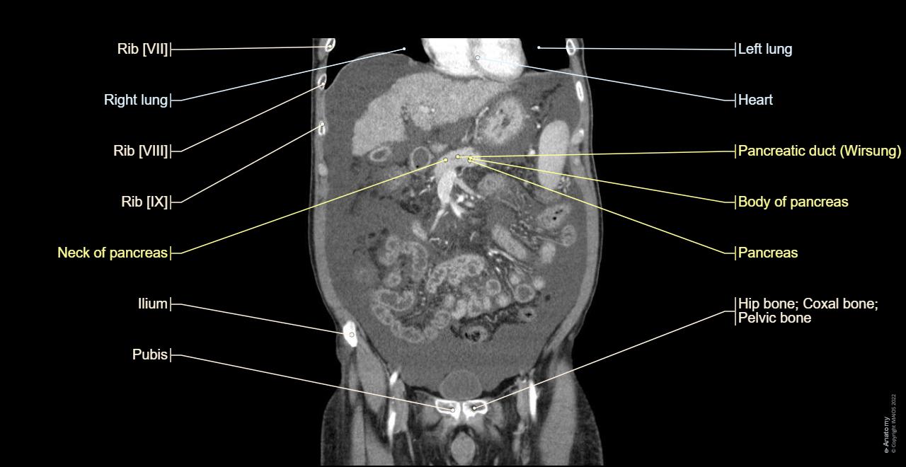 Anatomy of the abdominopelvic cavity (CT-Scan): Sigmoid mesocolon, Lesser omentum, Greater omentum, Visceral peritoneum