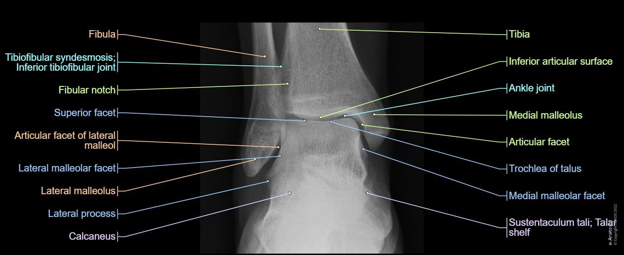 Ankle - : Ankle joint, Medial malleolus,Trochlea of talus