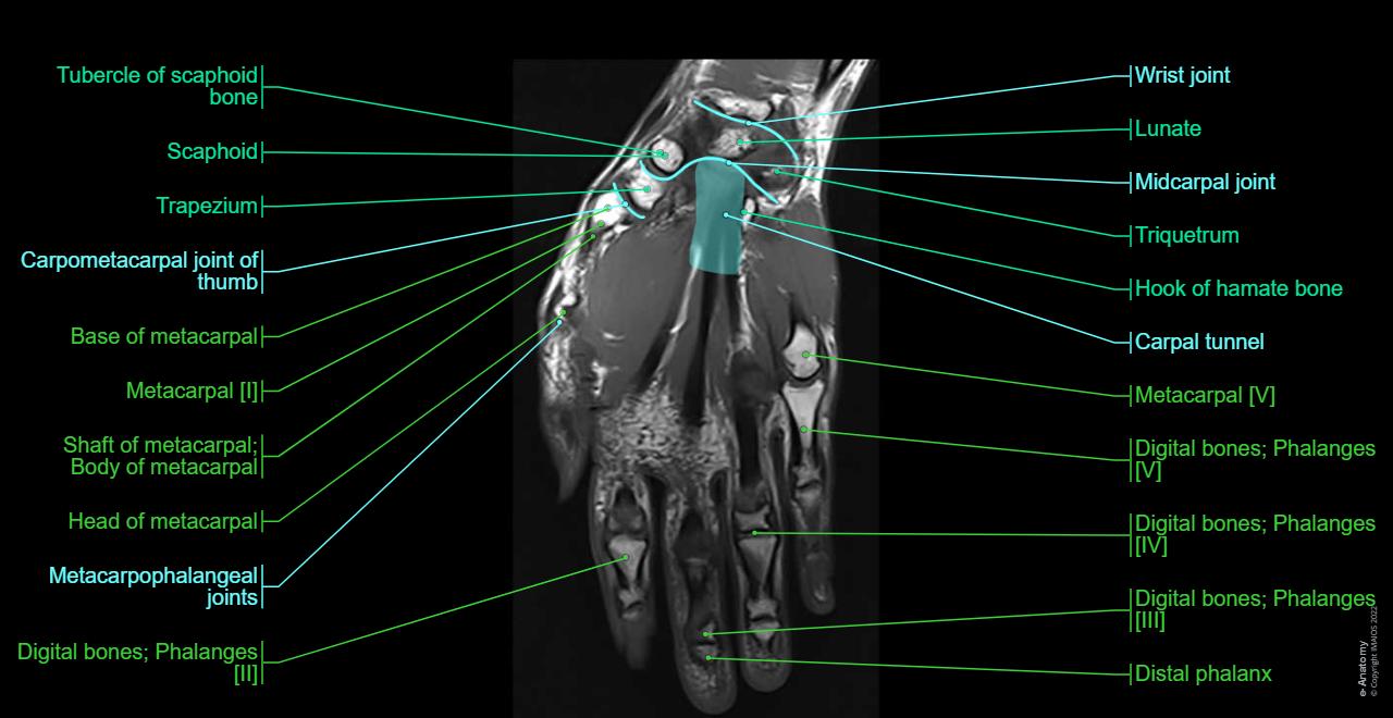 Carpal tunnel, Dorsal digital nerves, Joints of hand