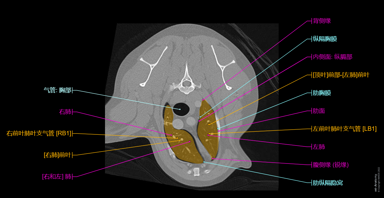 Vertebral column - CT (Labrador): Thoracic vertebrae, Vertebral body, Pedicle of vertebral arch, Spinous process