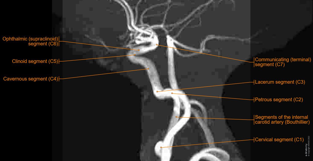 Segments of the internal carotid artery (Bouthillier): TOF-3D-MIP