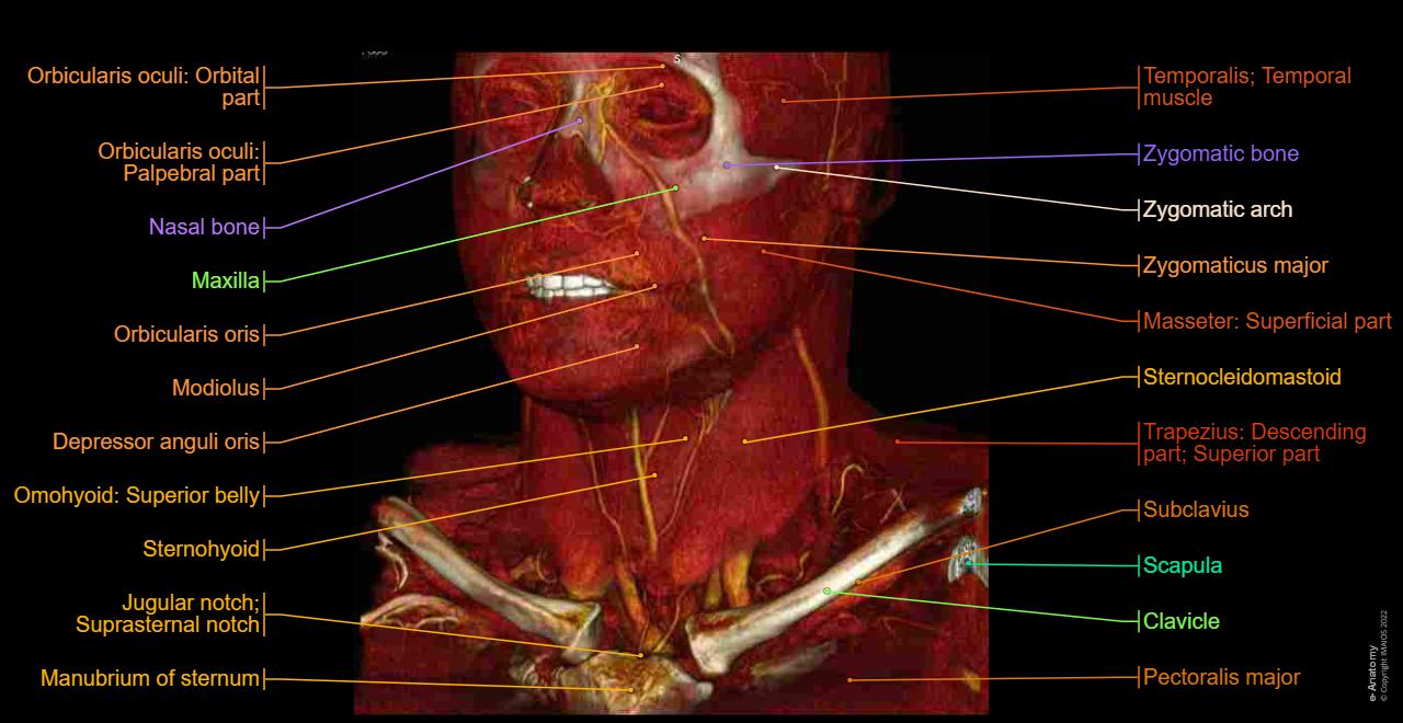 CT scan of head and neck