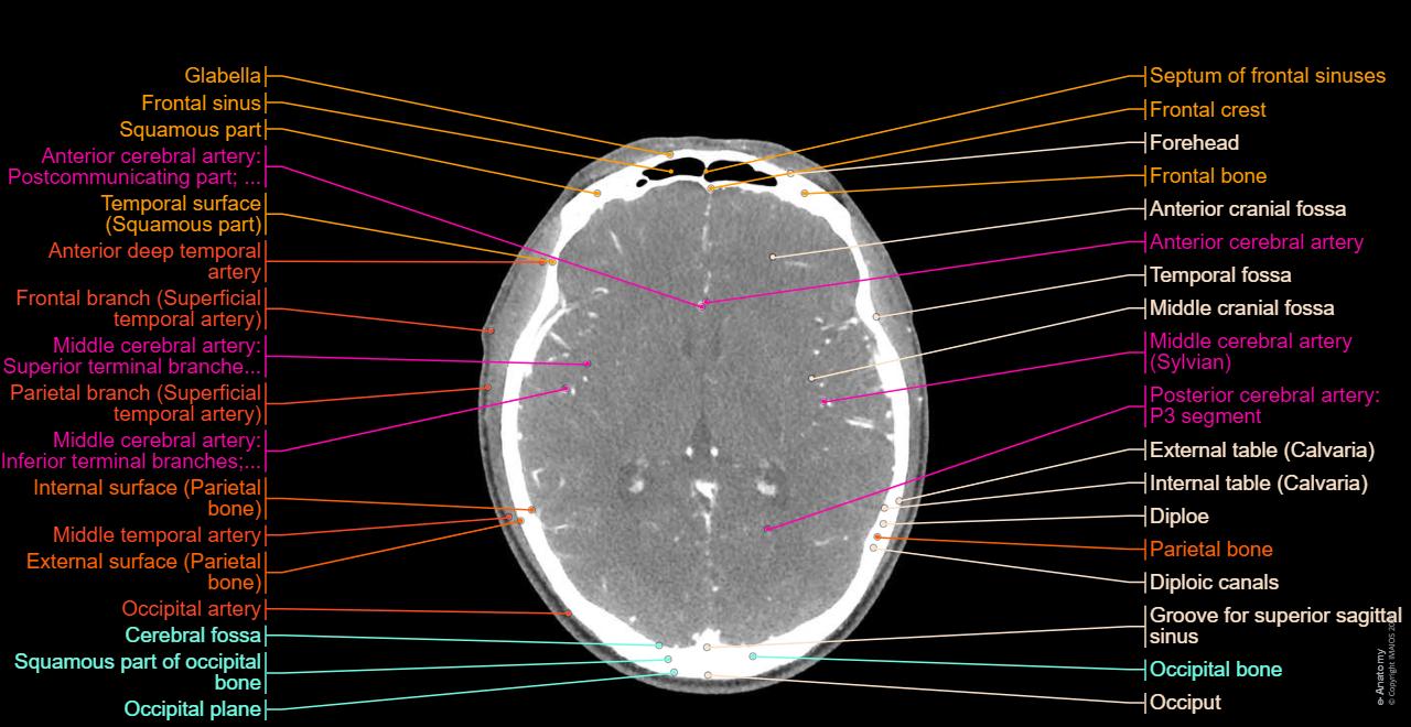 CT scan of head and neck