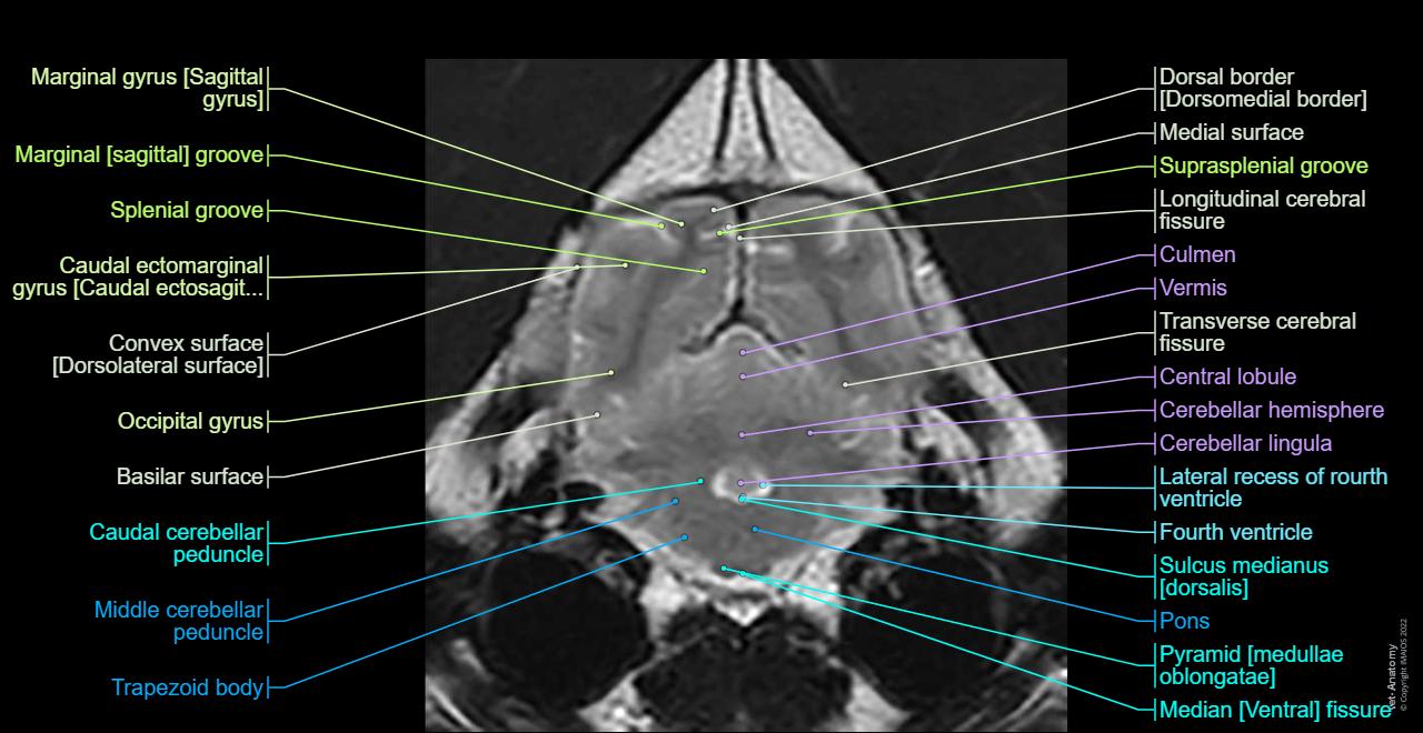 Animal - Brainstem - Anatomy: Sections of the pons, Middle cerebellar peduncle, Fourth ventricle