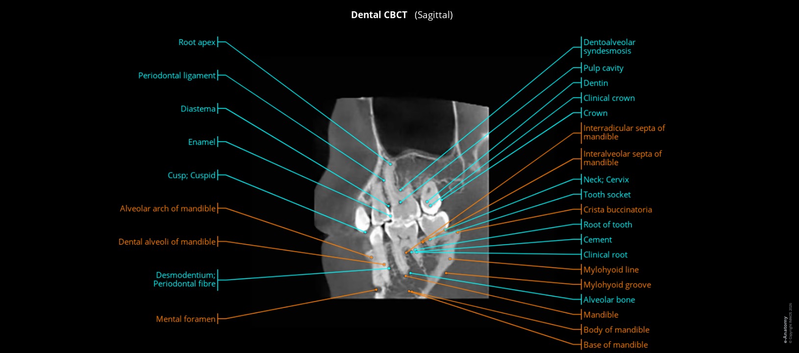 Dental cone beam in humans: sagittal section through the mandibular canal