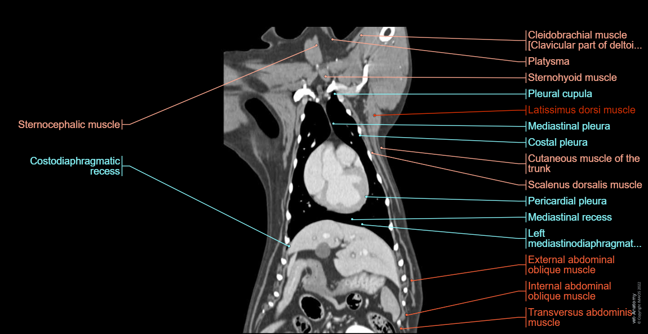 Anatomy - Liver (Dog): Diaphragmatic surface, Visceral surface, Fissure for round ligament, Right lobe of liver, Quadrate lobe, Papillary process (Caudate lobe), Left lobe of liver, Gallbladder