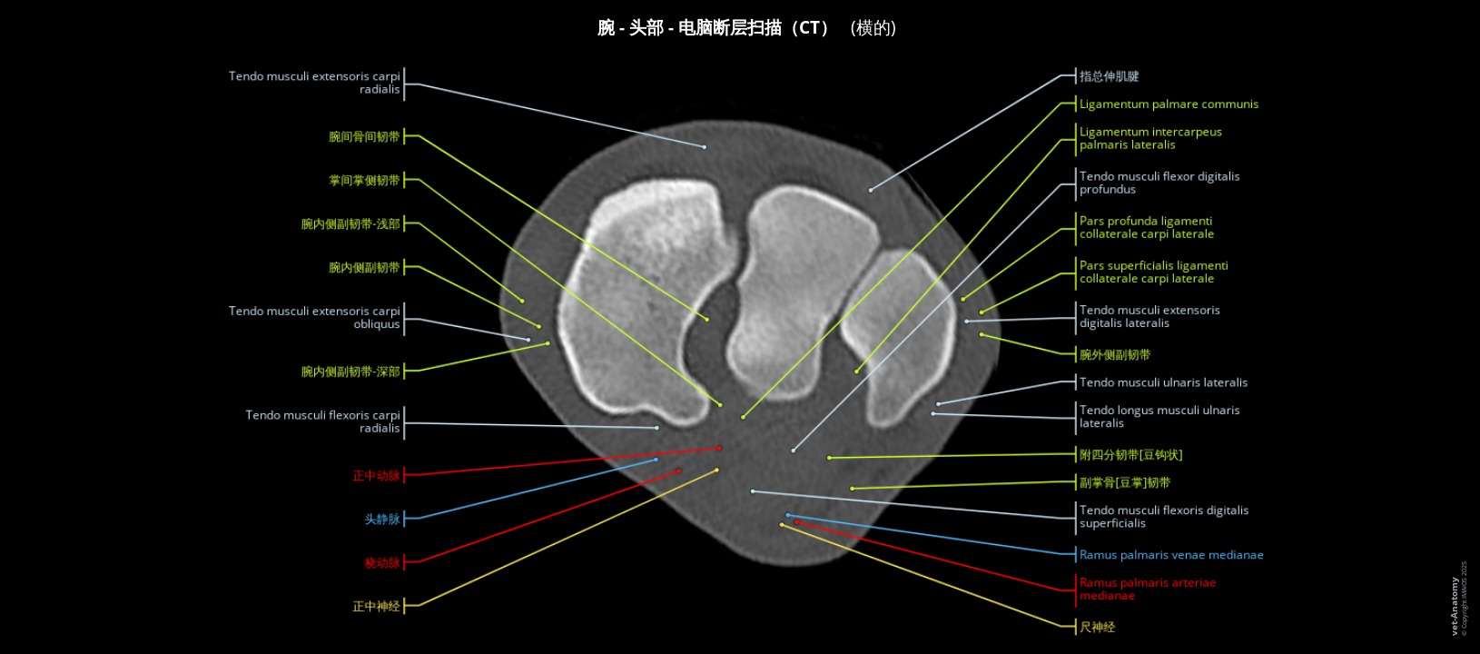 马腕关节CT标注图