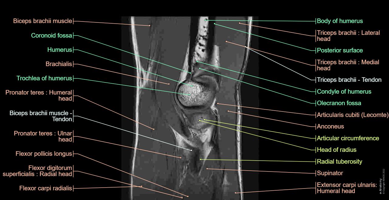 The elbow (MR): anatomical atlas on medical imaging