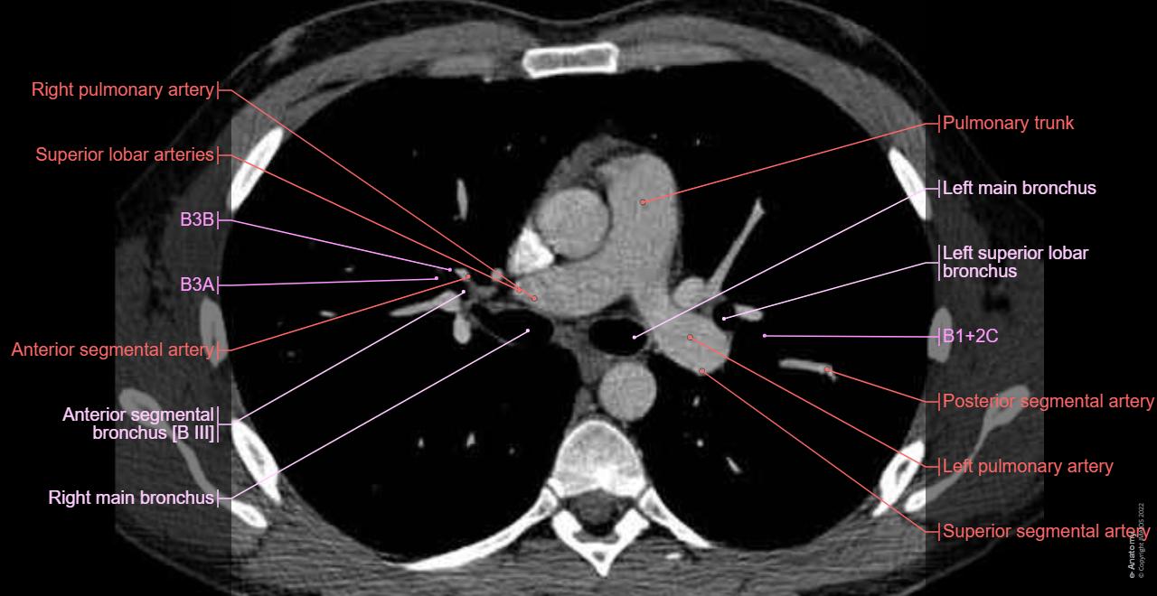 Anatomy atlas - Cross-sectional anatomy : Thorax, Lungs, Mediastinum