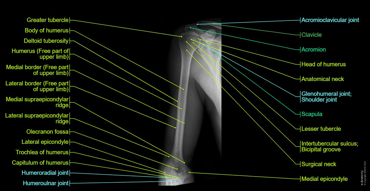Radiographs - Arm - Humerus : Body of humerus, Surgical neck, Medial supraepicondylar ridge, Medial epicondyle, Greater tubercle, Anatomical neck