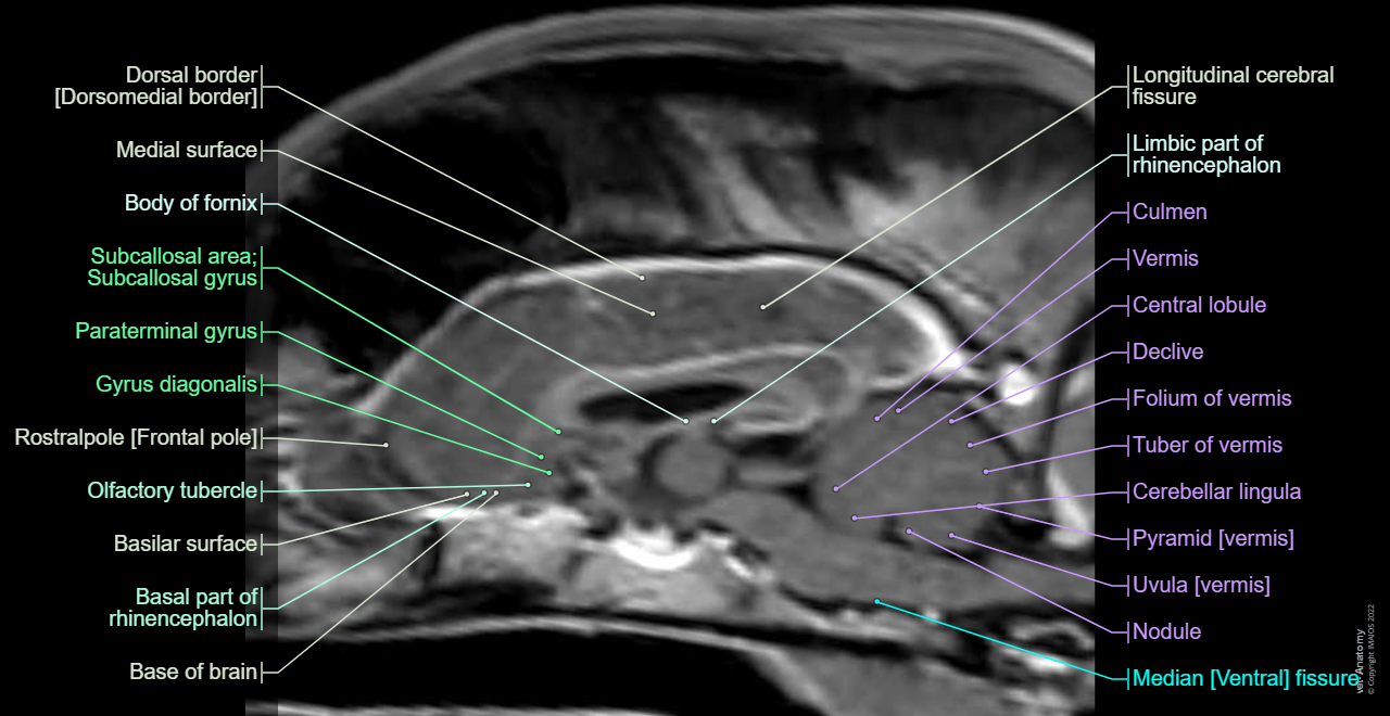 Canine Brain MRI Atlas - Veterinary Radiology: Hypophysis [Pituitary gland], Brainstem