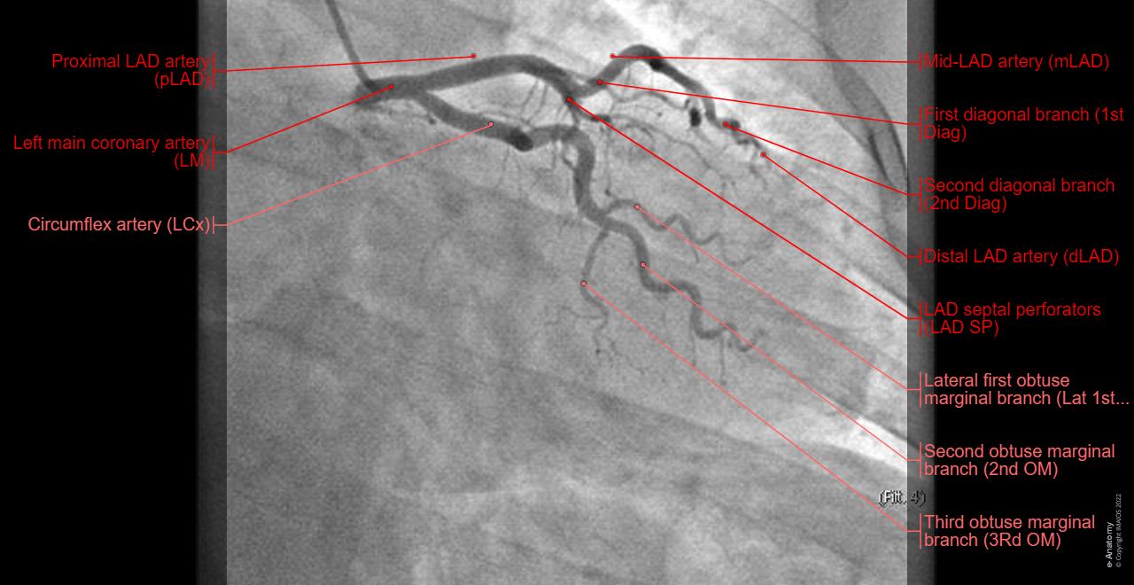 Coronary angiography : Coronary arteries - Anatomy