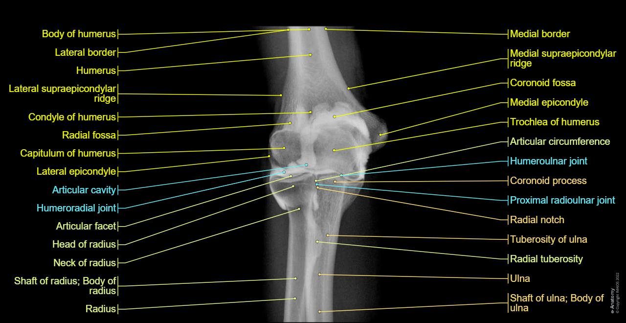Elbow : Arthrogram