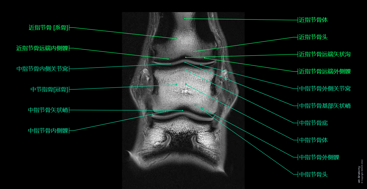 Anatomy atlas - Horse (MRI - PD - Dorsal): Thoracic limb - Forepaw