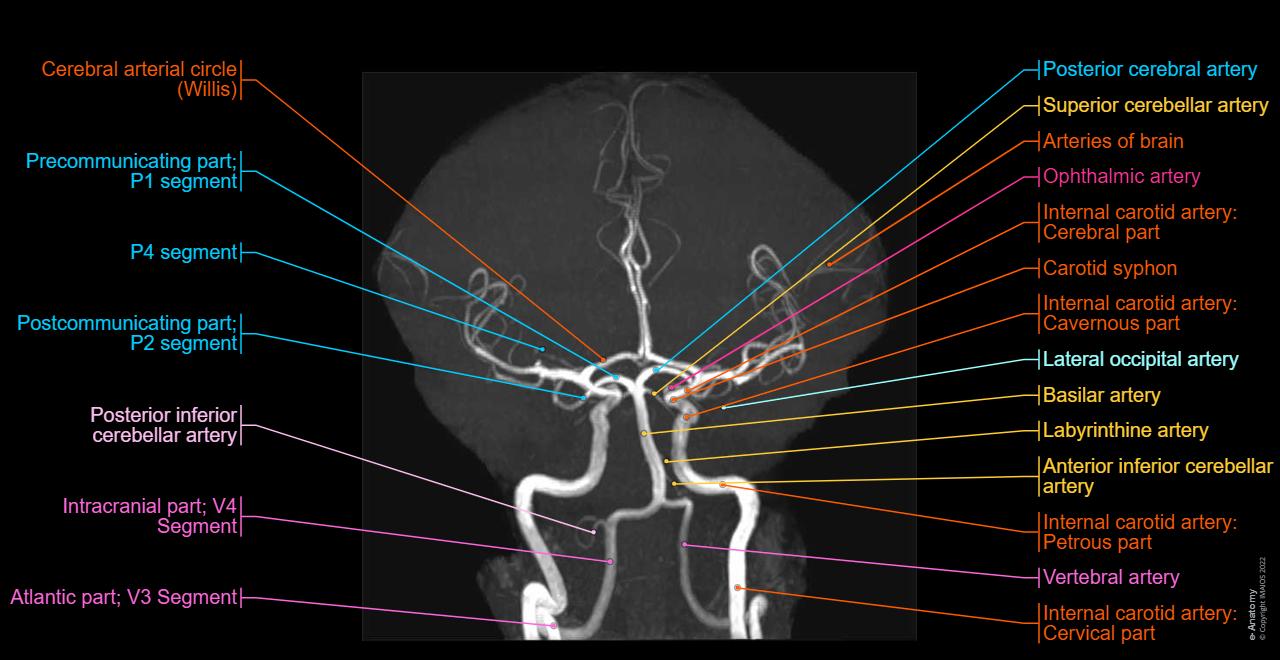 Atlas of arteries of the brain on a Time-Of-Flight (TOF) Magnetic Resonance Angiography (MRA)
