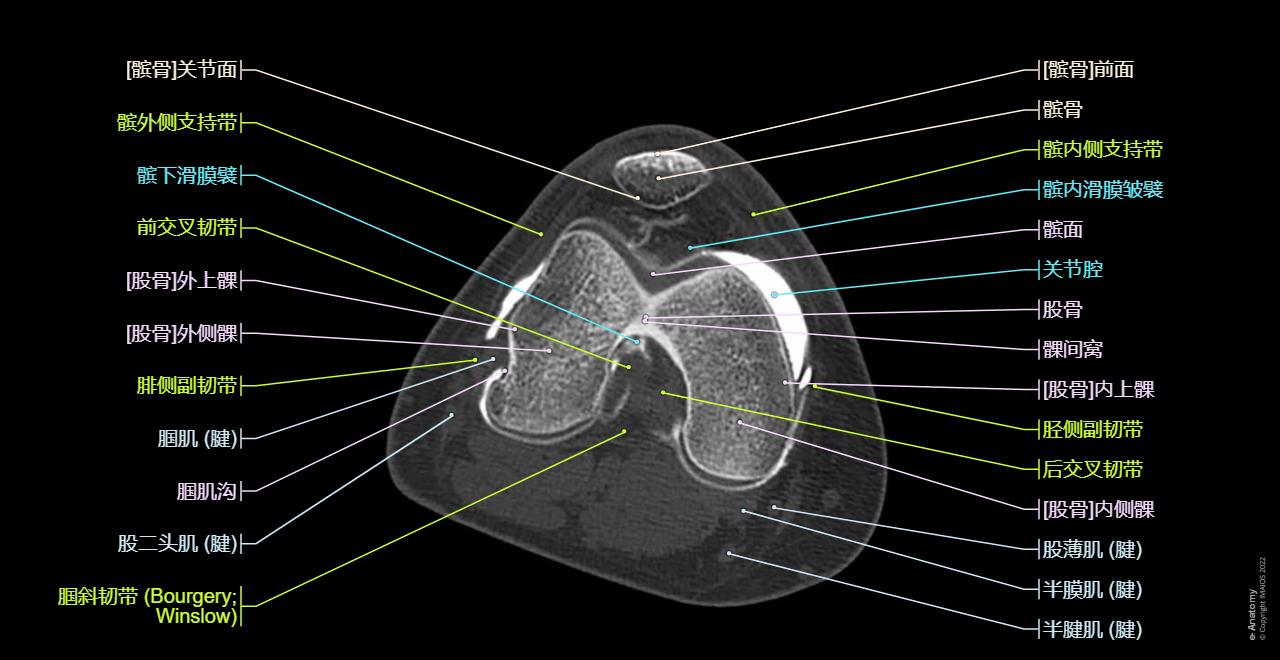Atlas of the anatomy of the joint of the knee on a CT arthrogram in axial, coronal, and sagittal sections, on a 3D images and on conventional athrogram