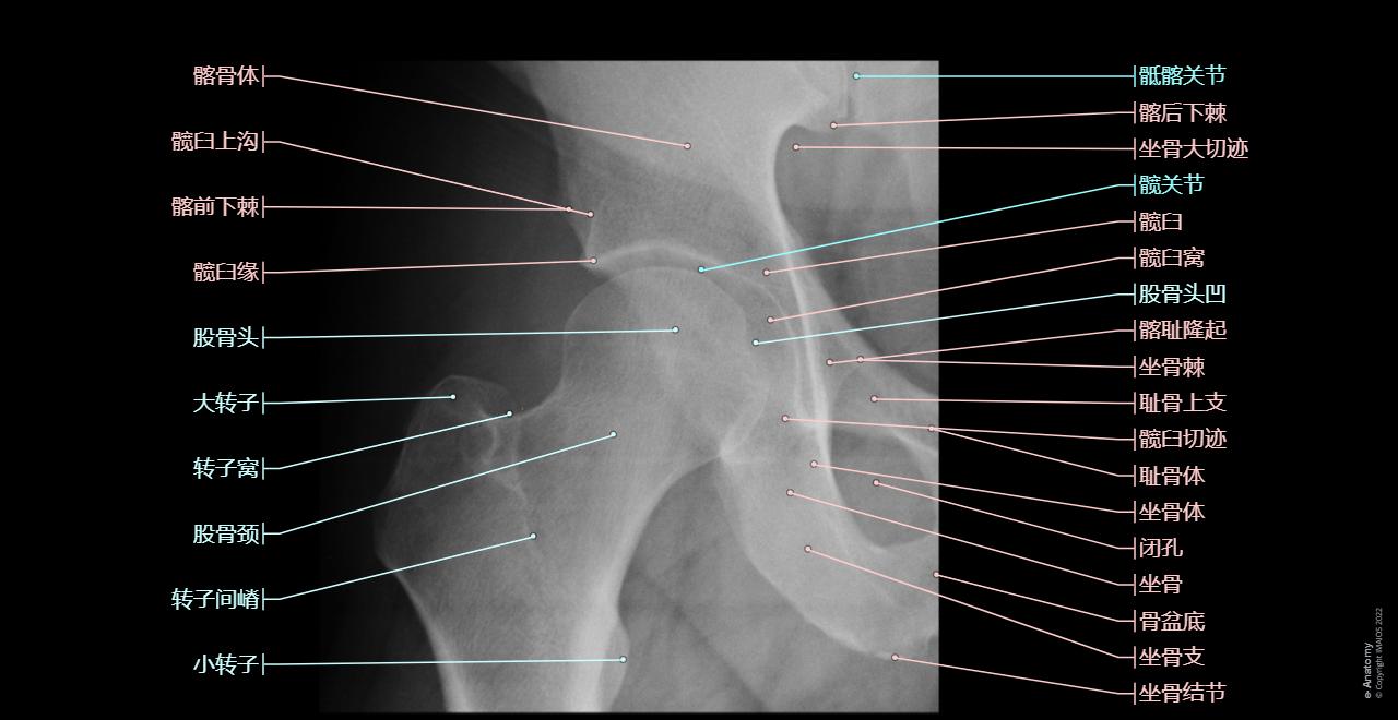 Anatomy of the lower limb in standard radiology: Hip, Hip joint, Head of femur