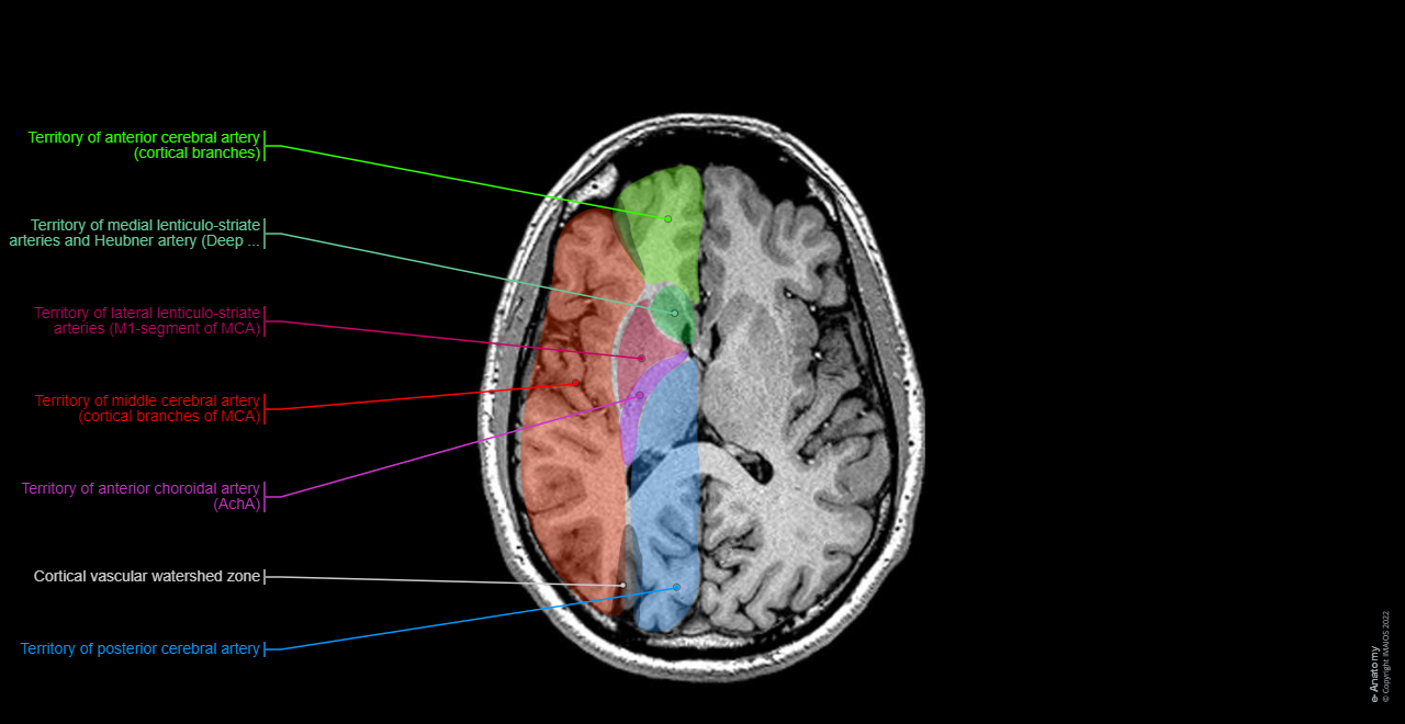 Vasculary territories - Brain