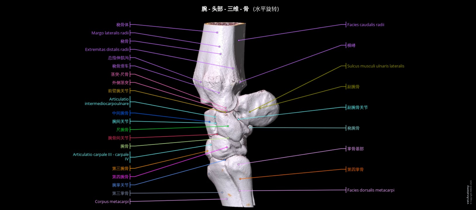 马桡骨、尺骨及腕关节三维模型