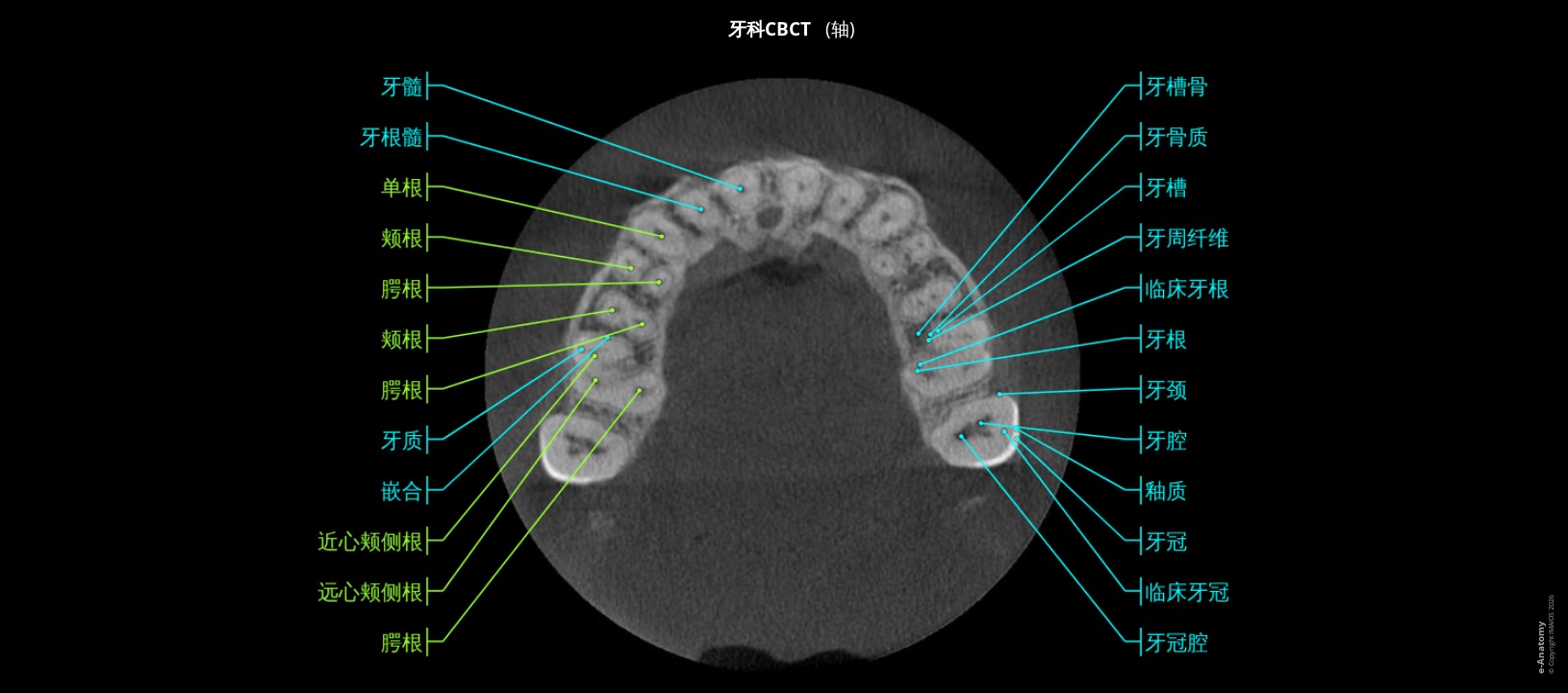 人类颌骨锥形束CT（CBCT）标注图像：经牙槽窝的轴位切面