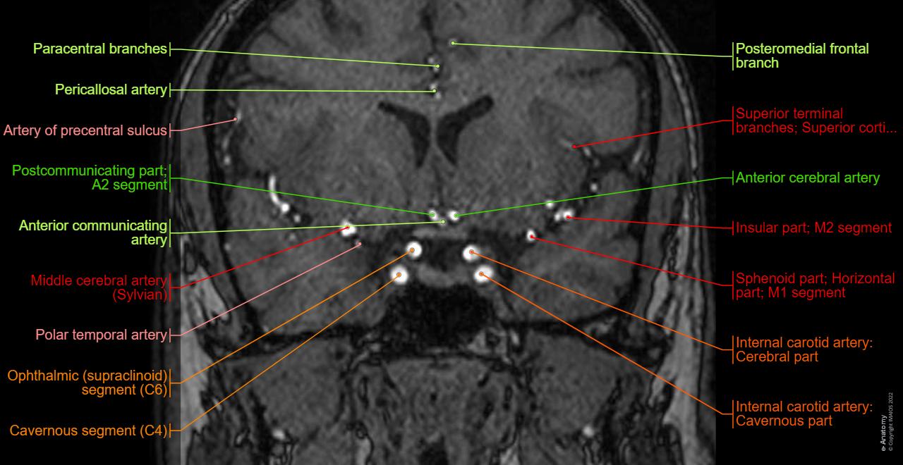 Anatomy of arteries of the brain and circle of Willis on a TOF MRA: Coronal section