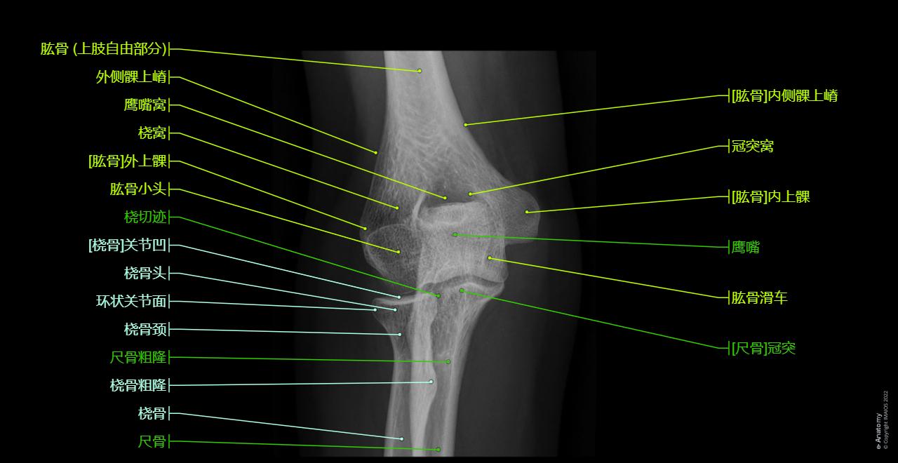 Elbow - Radiographs (Anterior-posterior view) : Lateral epicondyle, Trochlea of humerus, Coronoid process, Olecranon, Elbow joint, Humeroulnar joint, Humeroradial joint, Proximal radioulnar joint