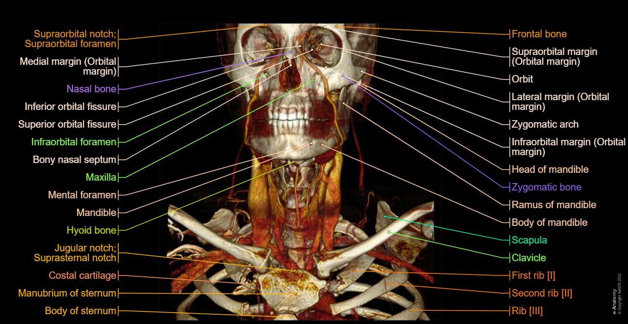 CT scan of head and neck