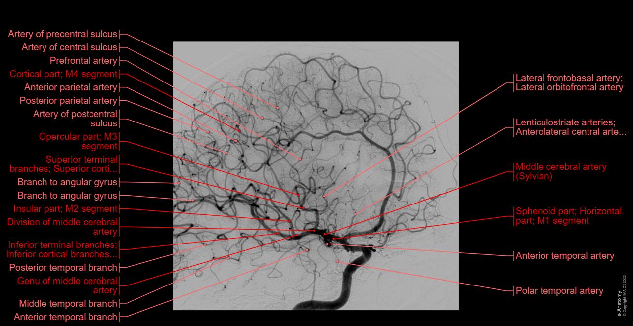 Brain Segment Normal Arteries of brain Angiography: normal anatomy | e-Anatomy