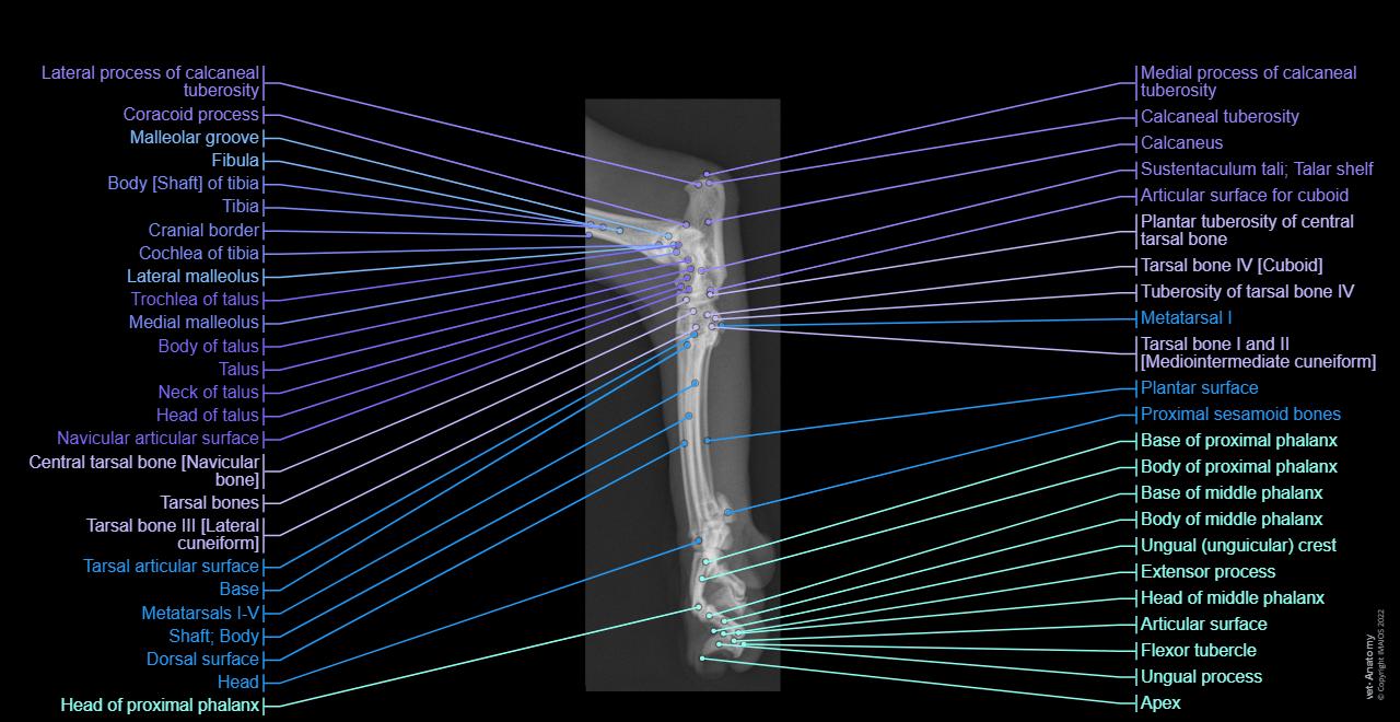 Foot - Radiography - Medio-lateral