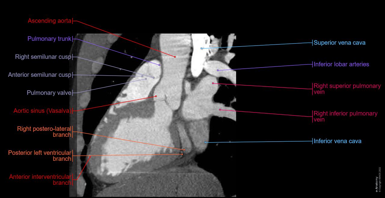 heart-cross-sectional-anato