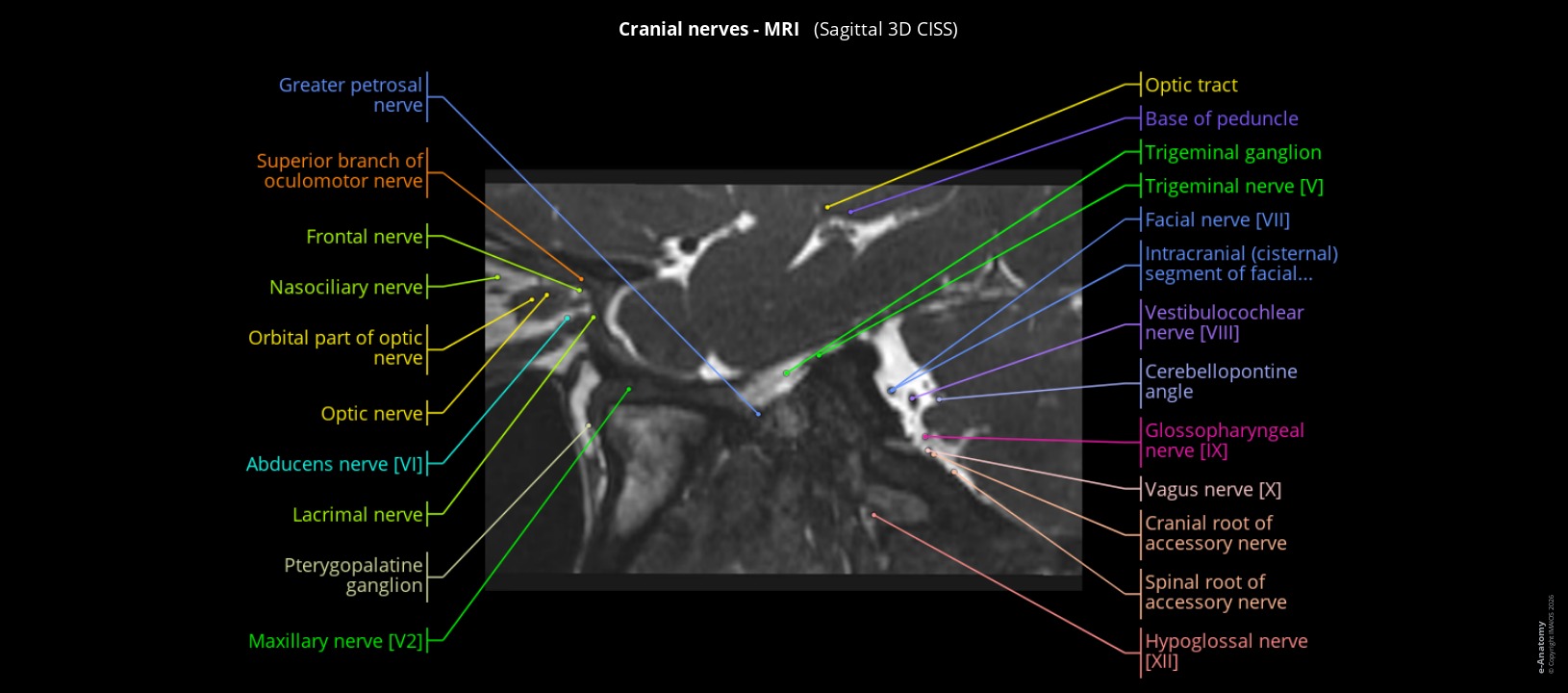 MRI of the cranial nerves in humans: sagittal CISS section
