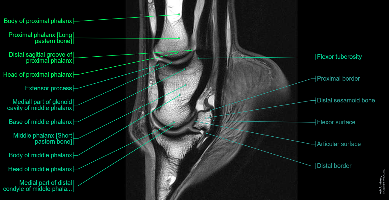 Anatomy of the equine digit (MRI): MRI - PD - Sagittal (Proximal phalanx [Long pastern bone], Middle phalanx [Short pastern bone], Distal phalanx [Ungual bone; Coffin bone; Pedal bone])