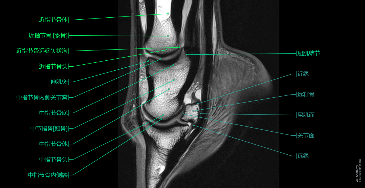 Anatomy of the equine digit (MRI): MRI - PD - Sagittal (Proximal phalanx [Long pastern bone], Middle phalanx [Short pastern bone], Distal phalanx [Ungual bone; Coffin bone; Pedal bone])