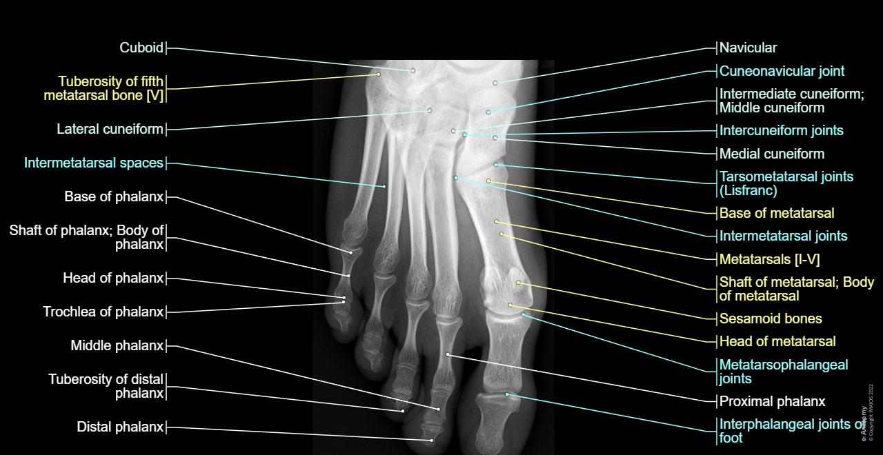 Foot - Toes : (Navicular, Medial cuneiform, Cuboid, Metatarsals, Phalanges