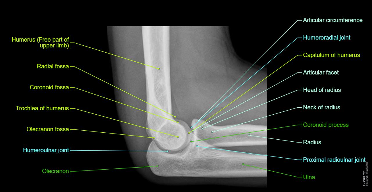 Joint - Cubital region - Radiographs - Anatomy : Humeroulnar joint, Humeroradial joint, Proximal radioulnar joint, Olecranon, Elbow, Olecranon fossa, Coronoid fossa, Radial fossa, Coronoid process