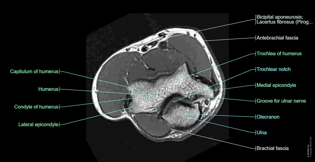 Anatomy of the elbow (MR)