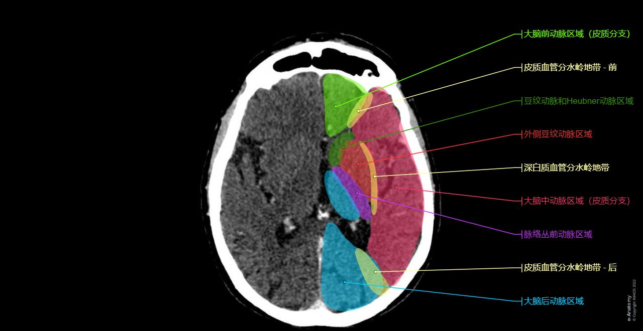 头部 CT : 正常解剖 | e-Anatomy