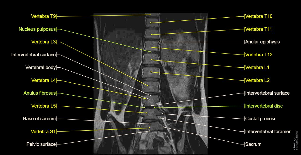 Anatomy of the lumbar spine using cross-sectional imaging (MR T1 and T2 weighted; sagittal, coronal and transverse slices)