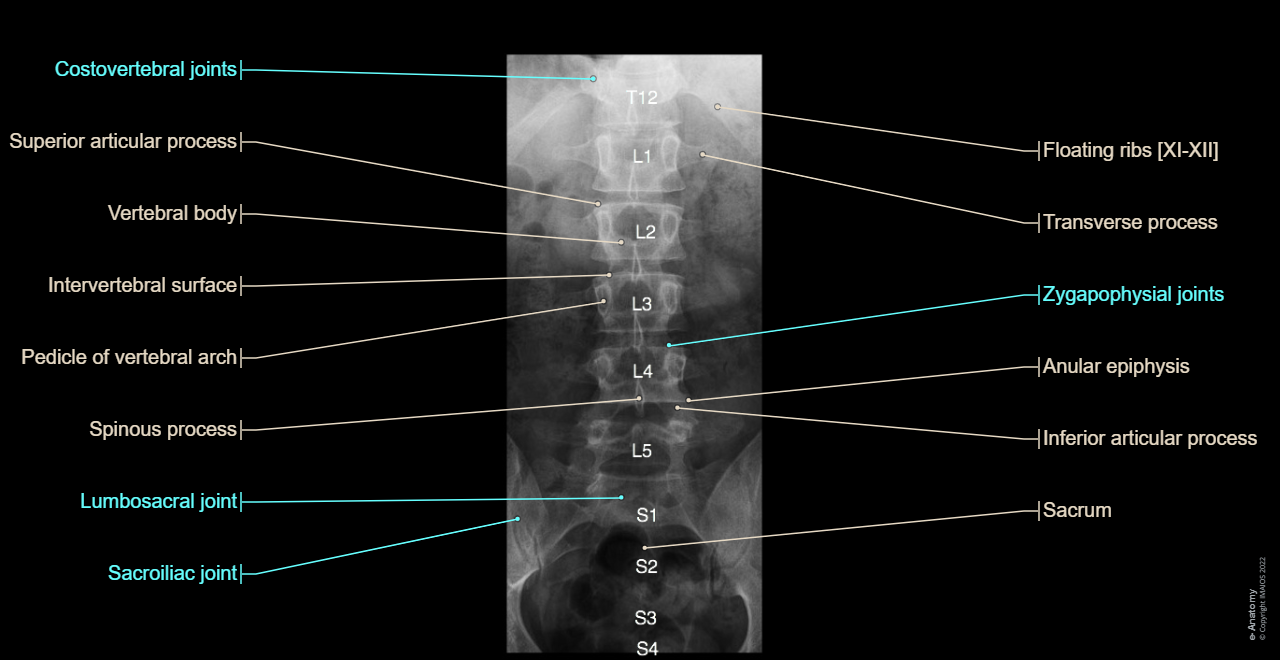 [UMLS:C0012249] - Lumbar vertebrae [LI-LV] : Transverse process, Anular epiphysis, Pedicle of vertebral arch, Superior articular process, Sacrum [sacral vertebrae I - V]