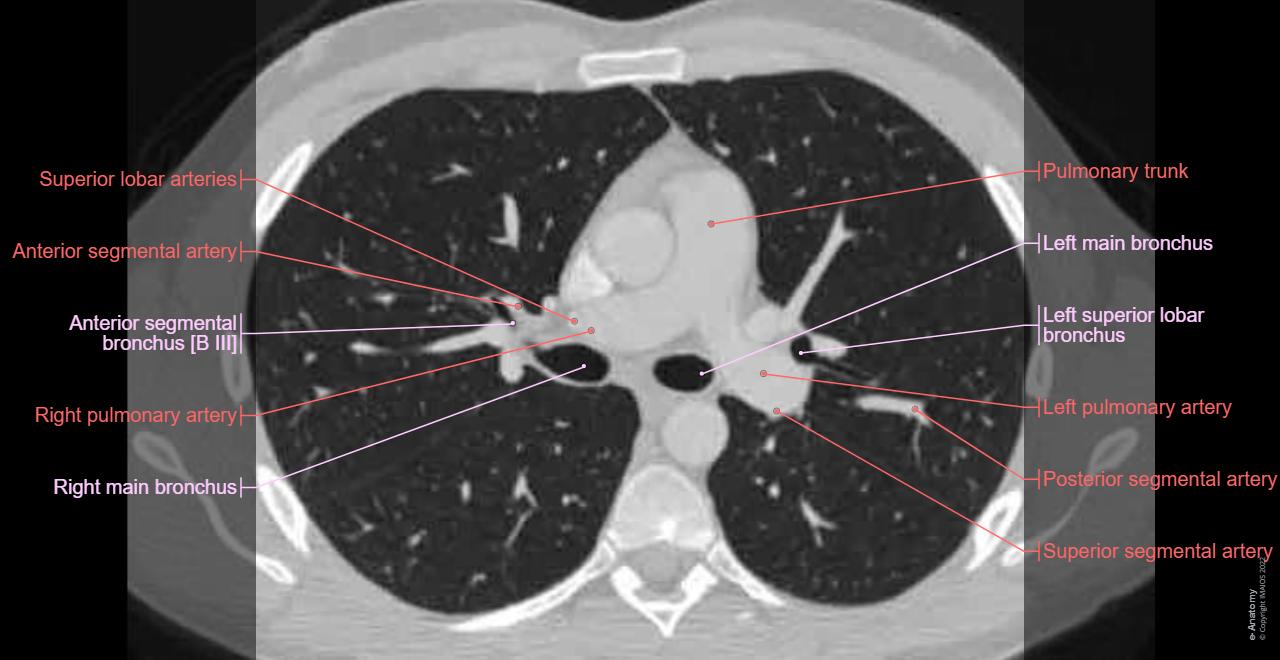 Anatomy atlas - Cross-sectional anatomy : Thorax, Lungs, Mediastinum