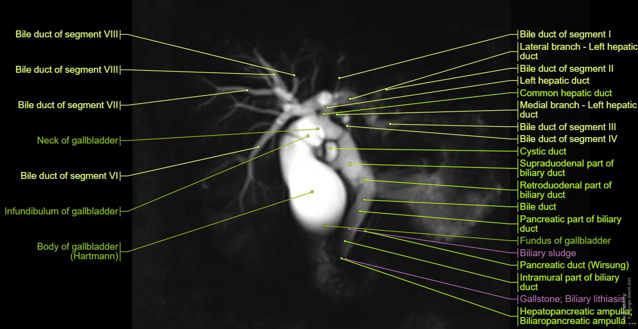 Normal Mrcp Biliary Magnetic Resonance Cholangiopancreatography: normal anatomy | e-Anatomy