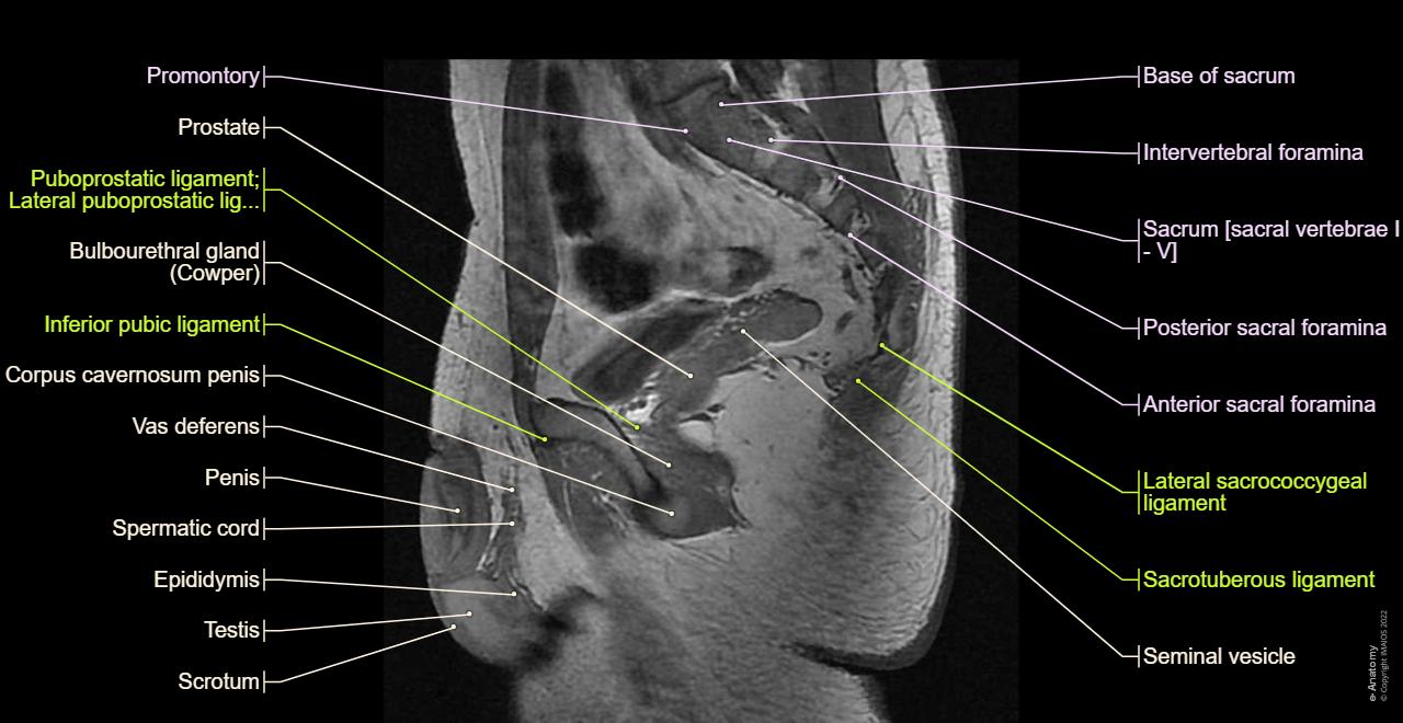 Cross-sectional anatomy - Male genital system: Prostate, Urinary bladder