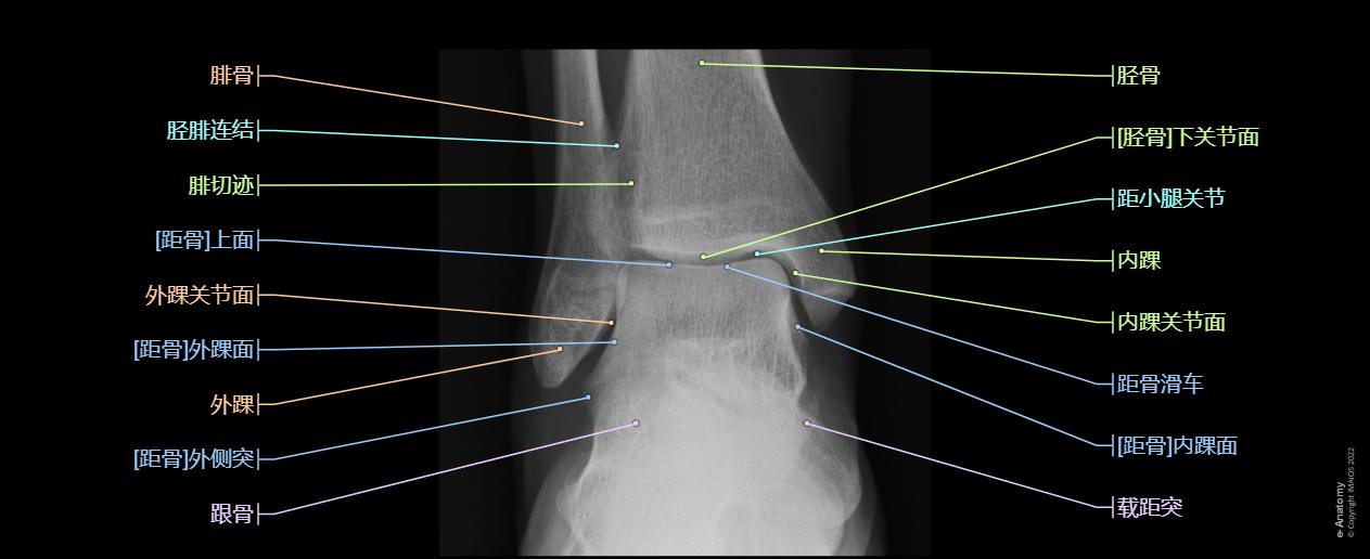 Ankle - : Ankle joint, Medial malleolus,Trochlea of talus