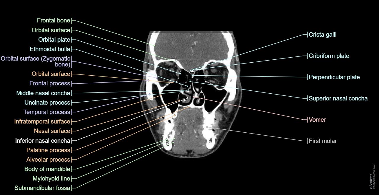 deep face spaces anatomy based on mdct : temporal space, parotid space, prevertebral space, retropharyngeal space, masticator space.