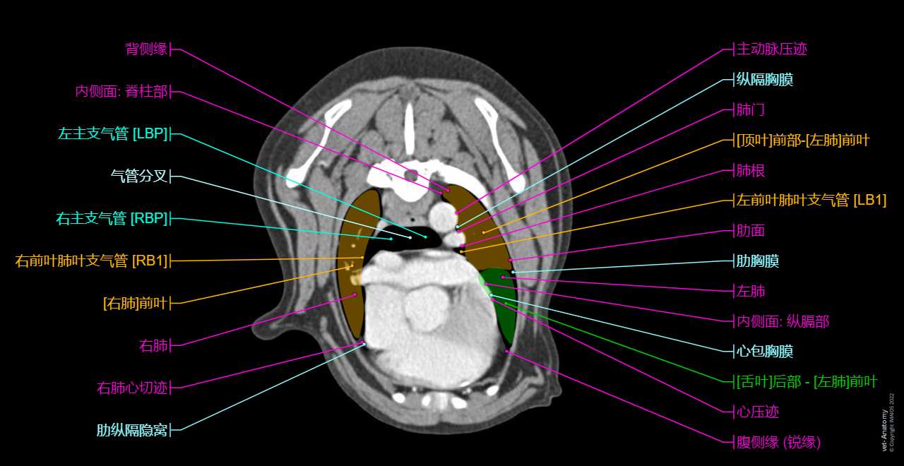 Dog - Muscles of back / Muscles of thorax: Latissimus dorsi muscle, Thoracic rhomboid muscle [Rhomboideus thoracis muscle], Cranial dorsal serrate muscle [Serratus dorsalis cranialis muscle], Erector spinae muscles