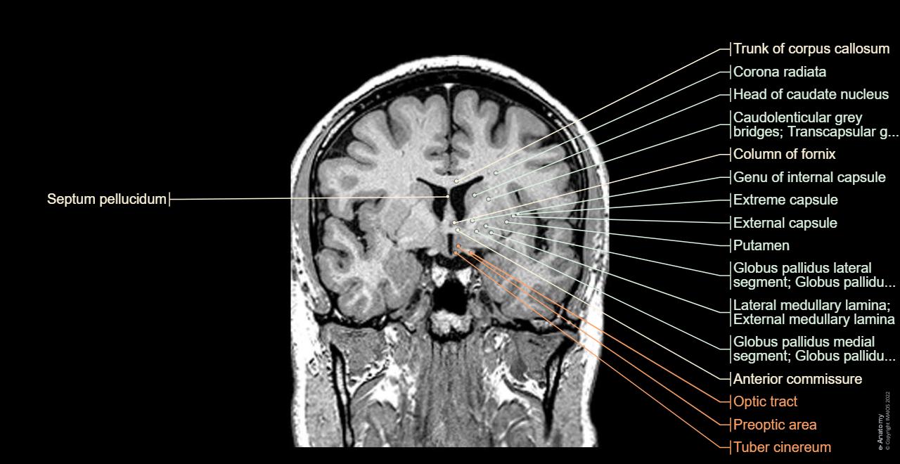 Brain MRI 3D: normal anatomy | e-Anatomy