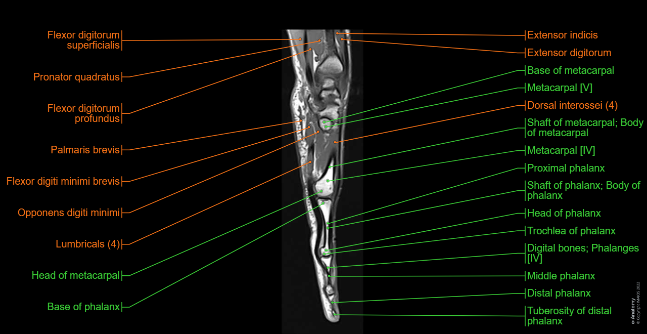 Wrist, Scaphoid, Metacarpals [I -V], Proximal phalanx