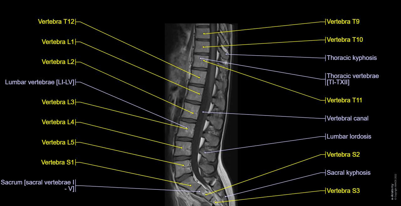 MRI - Vertebral column: Spinal cord, Intervertebral disc, Nucleus pulposus, Lumbar lordosis