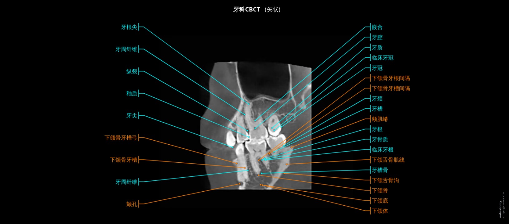 人类下颌骨锥形束CT：经下颌管的矢状切面